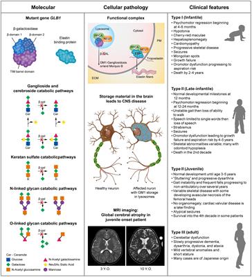 GM1 Gangliosidosis—A Mini-Review